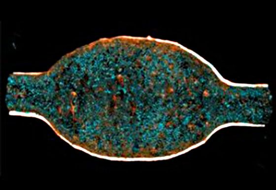 Mini-Blase zeigt Grund für Harnwegsinfektionen